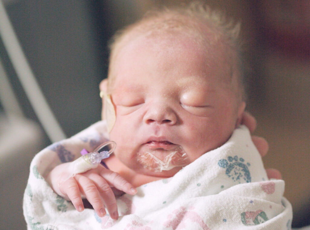 A newborn baby in the NICU receiving care.