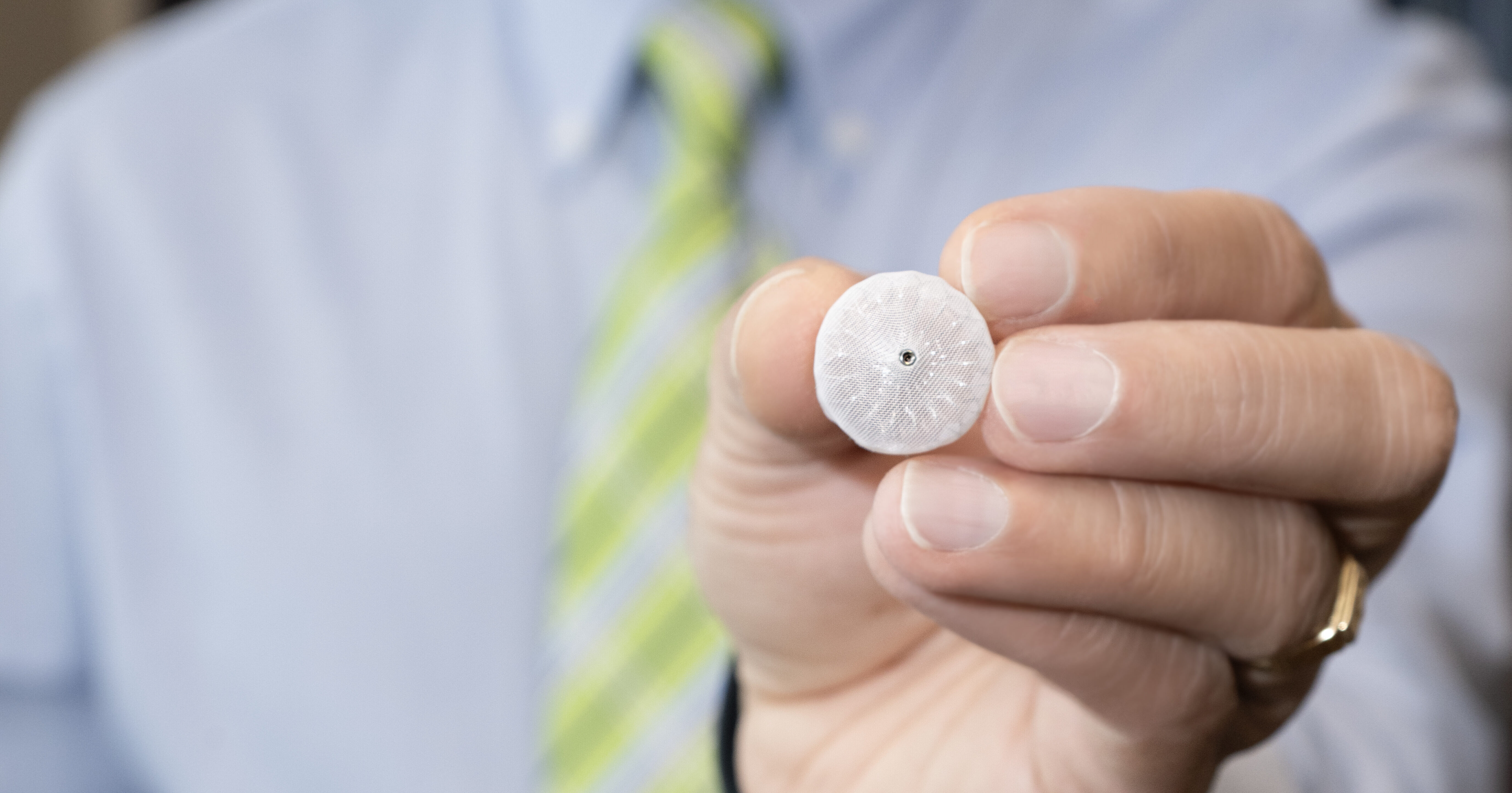 Dr. Shukla with device -the quarter-size WATCHMAN implant"